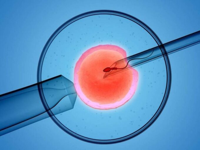 polycystic-ovarian-syndrome-according-to-the-age-of-the-woman-procedure-in-vitro-fertilization