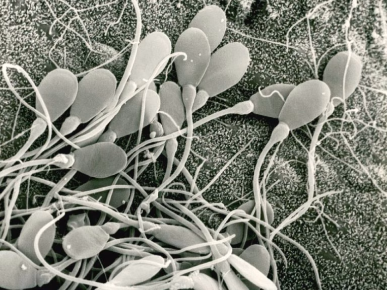 biopsia-testicular-para-detectar-el-origen-de-la-infertilidad-masculina-vista-microscopica-de-espermatozoides