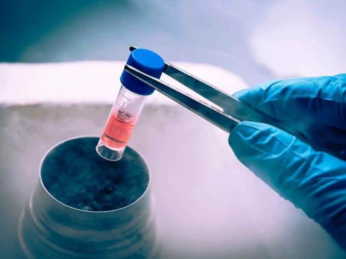 embriones-congelados-hace-30-anos-dan-vida-a-gemelos-imagen-de-celulas-congeladas-bajo-metodos-de-criopreservacion-mano-extrayendo-una-muestra-congelada